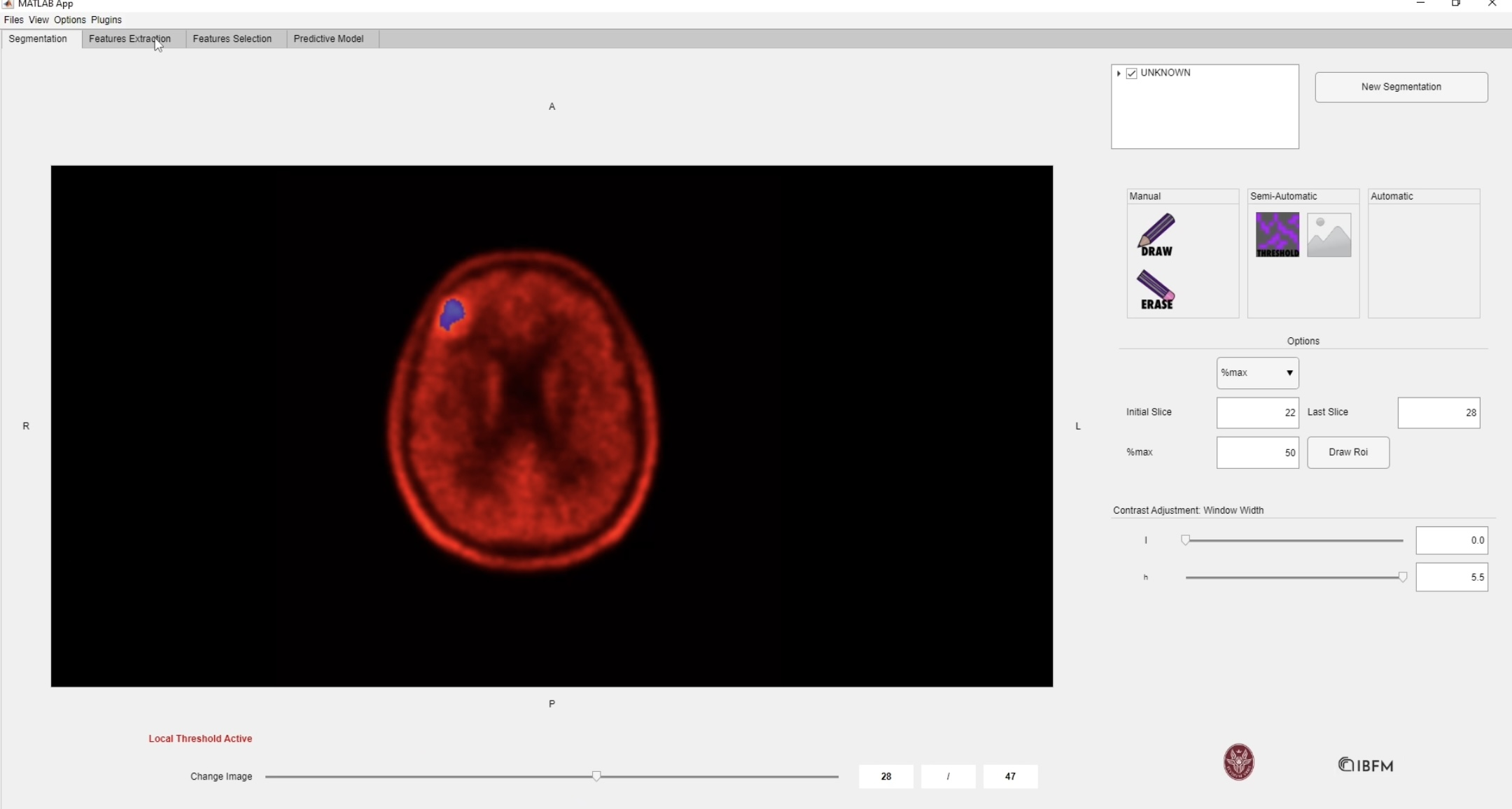 matRadiomics - Innovative Tool Radiomics Analysis